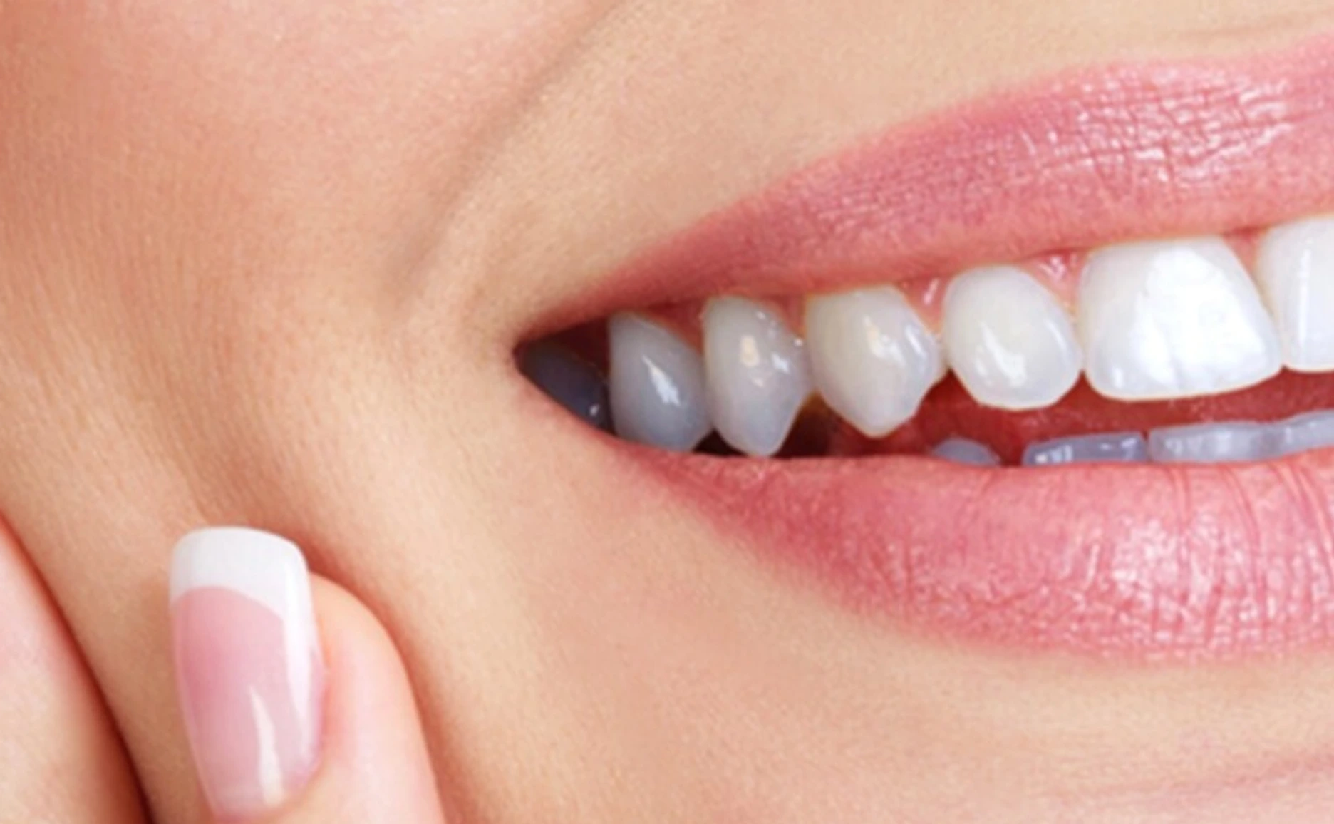 Dental Implants in cape town