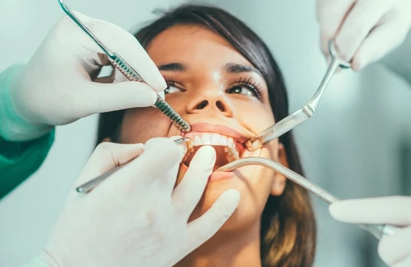 Dental Rehabilitation in cape town